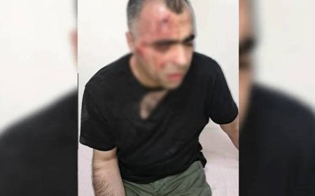 SİNAN AYGÜL YENİDEN HASTANEYE KALDIRILDI