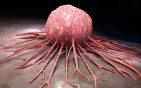 Kansere En Çok Yakalanan Kan Grubu Belli Oldu: Risk Yüzde 55 Daha Fazla